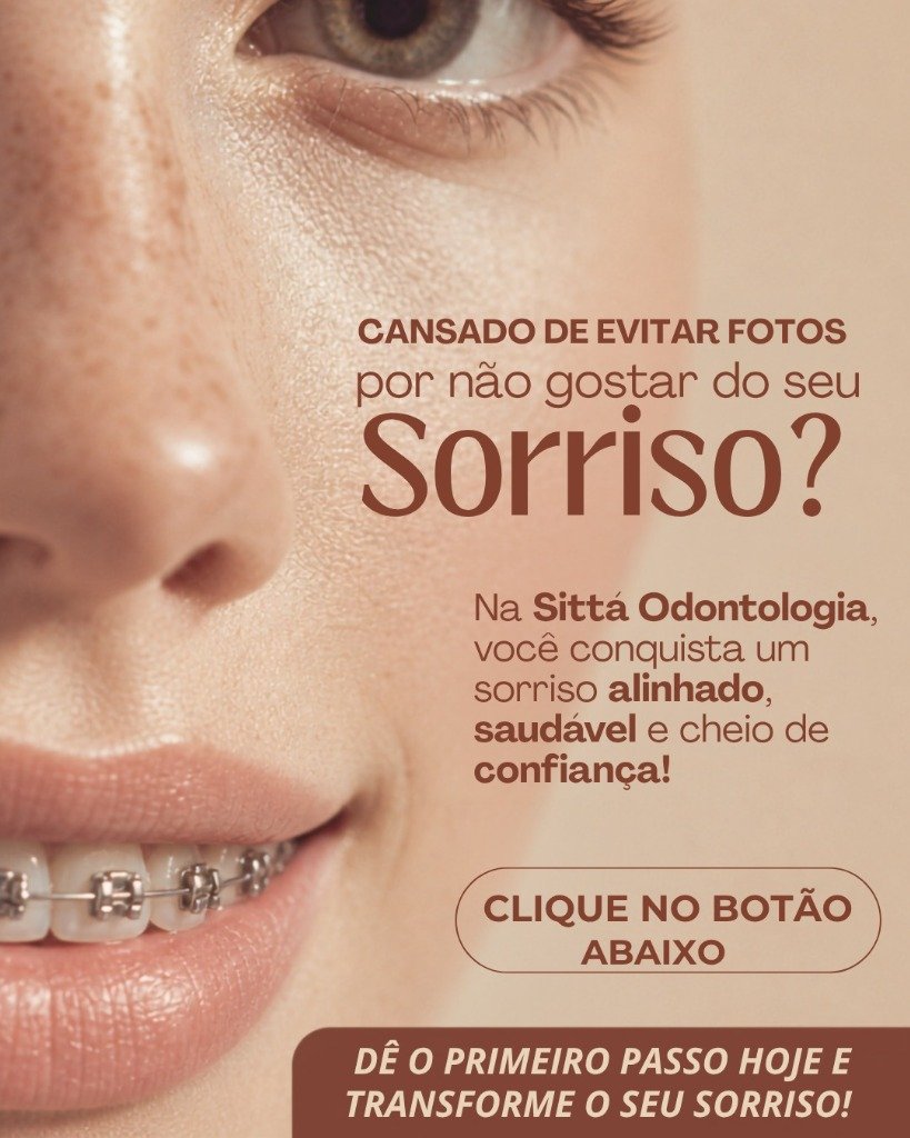 Aparelho Tradicional Metálico